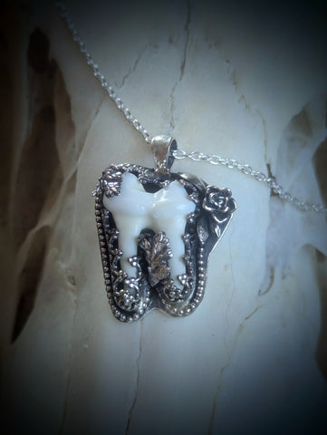 Wolf Tooth Necklace